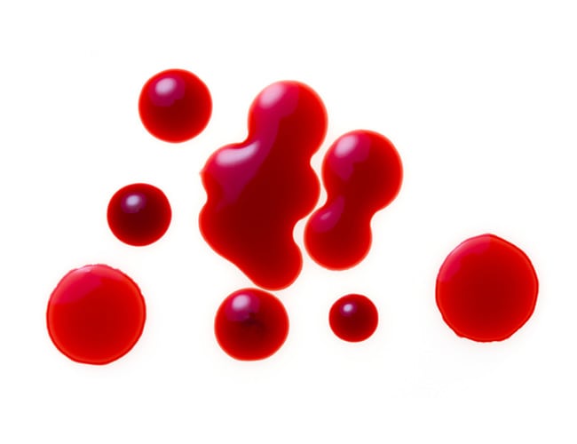 CMP Corona Pathology 2 - CMP CMP Corona Pathology 2 - CMP