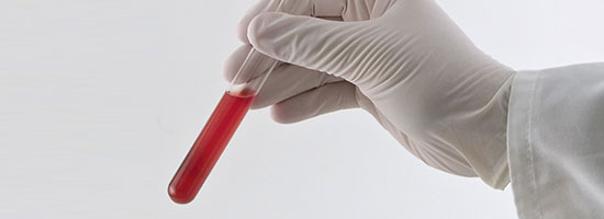 6-Things-a-Blood-Test-Can-Tell-You-Corona-Pathology