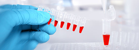 What-are-Biomarkers-Corona-Pathology