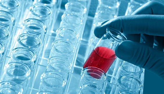 CBC Corona Pathology 1 - CBC CBC Corona Pathology 1 - CBC