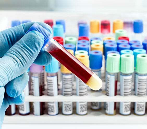 CBC Corona Pathology 2 - CBC CBC Corona Pathology 2 - CBC