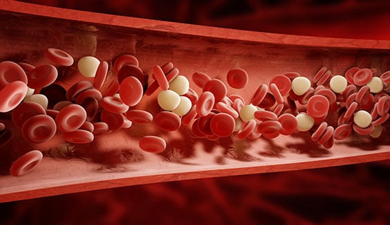 CMP Corona Pathology 1 - CMP CMP Corona Pathology 1 - CMP