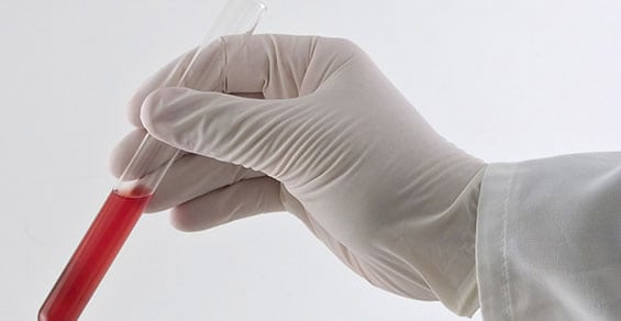Clinical Laboratory in California Corona Pathology - Clinical Laboratory in California Clinical Laboratory in California Corona Pathology - Clinical Laboratory in California