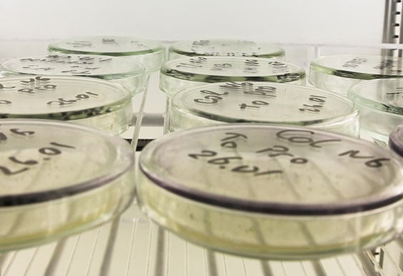 Clinical Laboratory in Los Angeles Corona Pathology 1 - Clinical Laboratory in Los Angeles Clinical Laboratory in Los Angeles Corona Pathology 1 - Clinical Laboratory in Los Angeles
