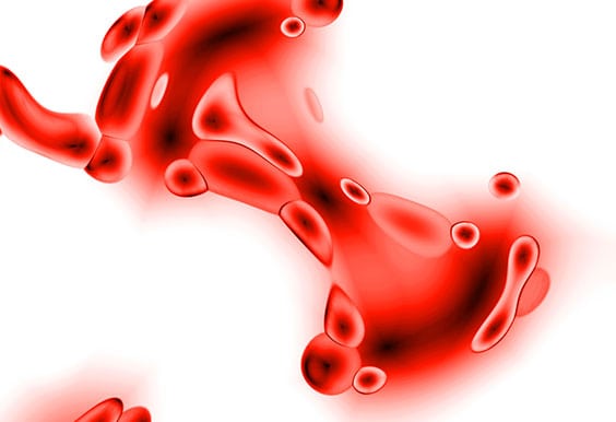 Clinical Laboratory in Los Angeles Corona Pathology 3 - Clinical Laboratory in Los Angeles Clinical Laboratory in Los Angeles Corona Pathology 3 - Clinical Laboratory in Los Angeles