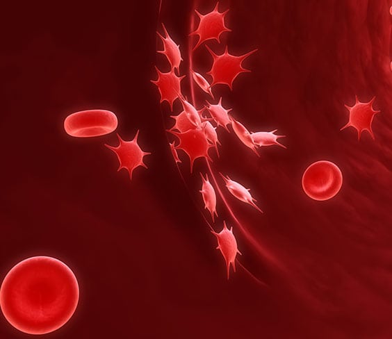 Clinical Pathology in California Corona Pathology 3 - Clinical Pathology in California Clinical Pathology in California Corona Pathology 3 - Clinical Pathology in California