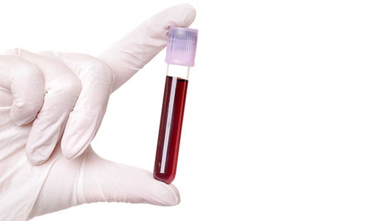 Clinical Pathology in Los Angeles Corona Pathology 1 - Clinical Pathology in Los Angeles Clinical Pathology in Los Angeles Corona Pathology 1 - Clinical Pathology in Los Angeles