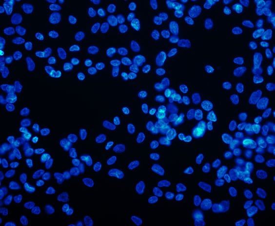Clinical Pathology in Los Angeles Corona Pathology 3 - Clinical Pathology in Los Angeles Clinical Pathology in Los Angeles Corona Pathology 3 - Clinical Pathology in Los Angeles