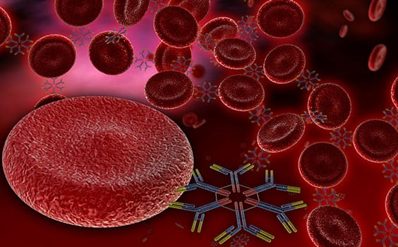 Coagulation Studies Corona Pathology 1 - Coagulation Studies Coagulation Studies Corona Pathology 1 - Coagulation Studies