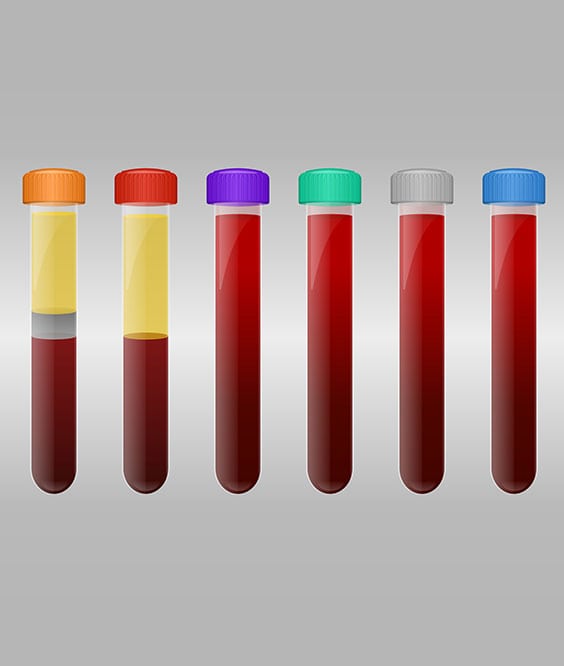 Coagulation Studies Corona Pathology 2 1 - Coagulation Studies Coagulation Studies Corona Pathology 2 1 - Coagulation Studies