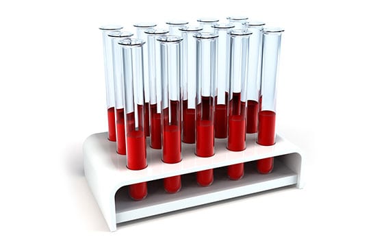 GI Infections Corona Pathology 2 - GI Infections GI Infections Corona Pathology 2 - GI Infections