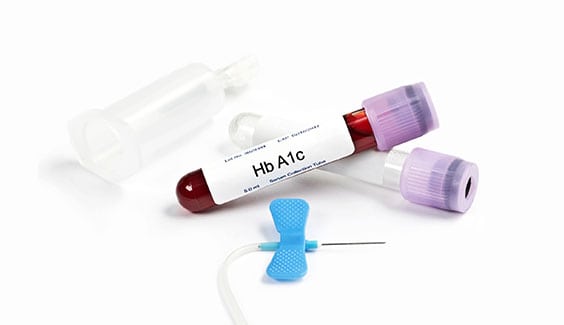 Hemoglobin A1C Corona Pathology 1 - Hemoglobin (A1C) Hemoglobin A1C Corona Pathology 1 - Hemoglobin (A1C)