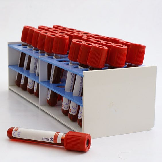 Immunology Clinical Laboratory in California Corona Pathology 2 - Immunology Clinical Laboratory in California Immunology Clinical Laboratory in California Corona Pathology 2 - Immunology Clinical Laboratory in California