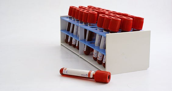 Liver Function Tests Corona Pathology 1 - Liver Function Tests Liver Function Tests Corona Pathology 1 - Liver Function Tests