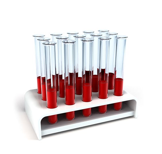 Medical Laboratory in California Corona Pathology 2 - Medical Laboratory in California Medical Laboratory in California Corona Pathology 2 - Medical Laboratory in California