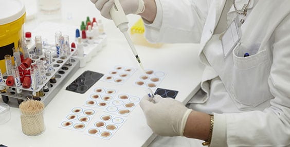 Medical Laboratory in Los Angeles Corona Pathology 1 - Medical Laboratory in Los Angeles Medical Laboratory in Los Angeles Corona Pathology 1 - Medical Laboratory in Los Angeles