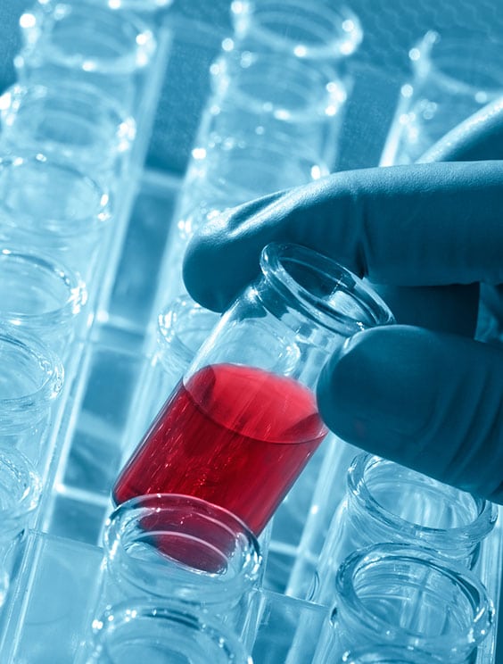 Medical Laboratory in Los Angeles Corona Pathology 2 - Medical Laboratory in Los Angeles Medical Laboratory in Los Angeles Corona Pathology 2 - Medical Laboratory in Los Angeles