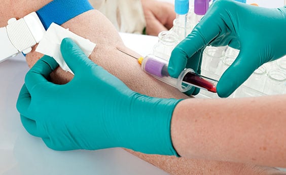 Medical Laboratory in Los Angeles Corona Pathology 3 - Medical Laboratory in Los Angeles Medical Laboratory in Los Angeles Corona Pathology 3 - Medical Laboratory in Los Angeles