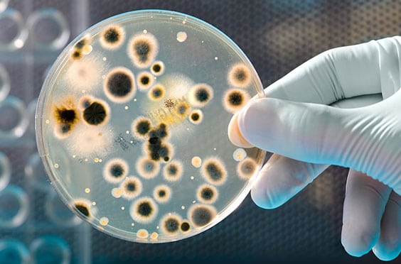 Molecular Bacteriology Virology Corona Pathology 2 - Molecular Bacteriology & Virology Molecular Bacteriology Virology Corona Pathology 2 - Molecular Bacteriology & Virology
