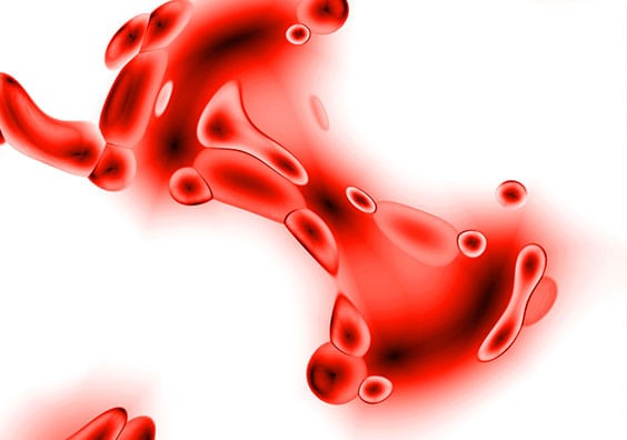 OTT Corona Pathology 2 - OTT OTT Corona Pathology 2 - OTT