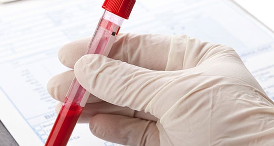 PT Corona Pathology 1 - PT PT Corona Pathology 1 - PT