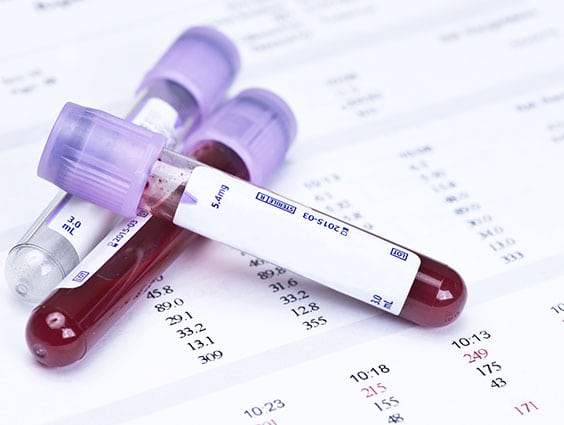Routine Hematology Corona Pathology - Routine Hematology Routine Hematology Corona Pathology - Routine Hematology