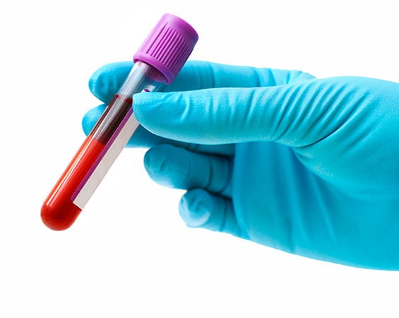 Serology Corona Pathology 1 1 - Serology Serology Corona Pathology 1 1 - Serology