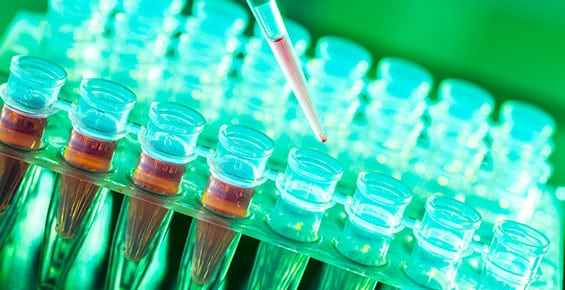 Serology Corona Pathology 1 - Serology Serology Corona Pathology 1 - Serology