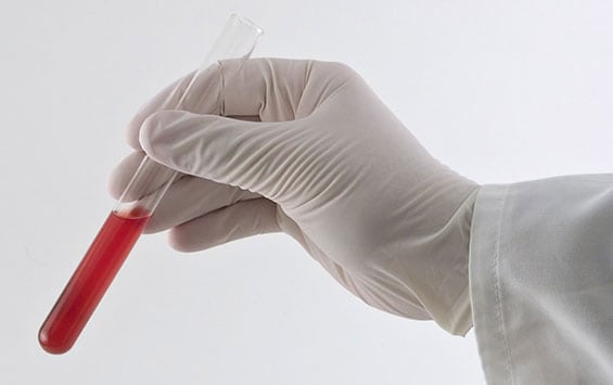 Toxicology Corona Pathology - Toxicology Toxicology Corona Pathology - Toxicology