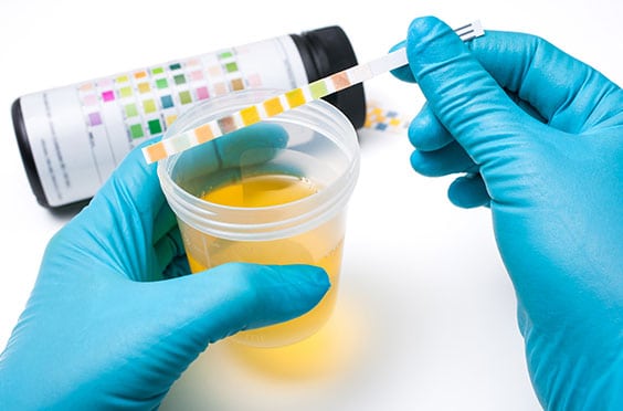 Toxicology Lab in Los Angeles Corona Pathology 1 - Toxicology Lab in Los Angeles Toxicology Lab in Los Angeles Corona Pathology 1 - Toxicology Lab in Los Angeles