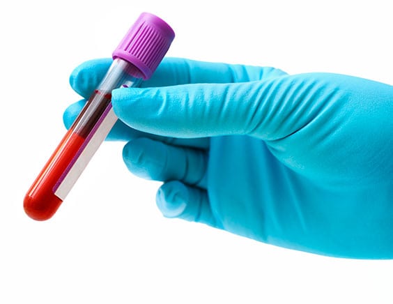 Toxicology Lab in Los Angeles Corona Pathology 2 - Toxicology Lab in Los Angeles Toxicology Lab in Los Angeles Corona Pathology 2 - Toxicology Lab in Los Angeles