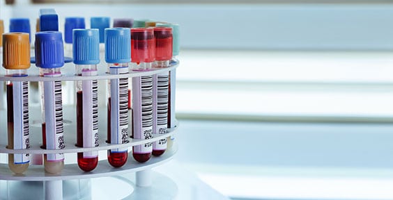 Toxicology Testing Lab in California Corona Pathology 1 - Toxicology Testing Lab in California Toxicology Testing Lab in California Corona Pathology 1 - Toxicology Testing Lab in California