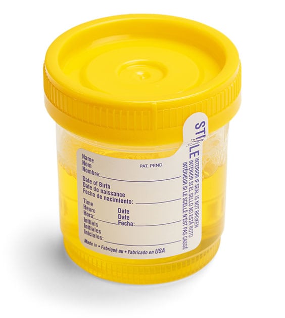 Toxicology Testing Lab in California Corona Pathology 2 - Toxicology Testing Lab in California Toxicology Testing Lab in California Corona Pathology 2 - Toxicology Testing Lab in California