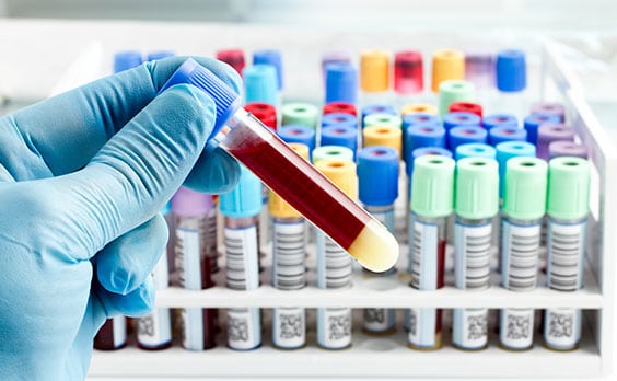 Toxicology Testing Lab in Los Angeles | Corona Pathology