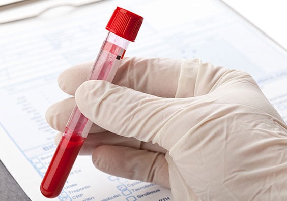 Toxicology Testing Lab in Los Angeles Corona Pathology 2 - Toxicology Testing Lab in Los Angeles Toxicology Testing Lab in Los Angeles Corona Pathology 2 - Toxicology Testing Lab in Los Angeles