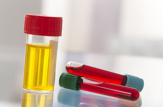 Toxicology Testing Lab in Los Angeles Corona Pathology 3 - Toxicology Testing Lab in Los Angeles Toxicology Testing Lab in Los Angeles Corona Pathology 3 - Toxicology Testing Lab in Los Angeles
