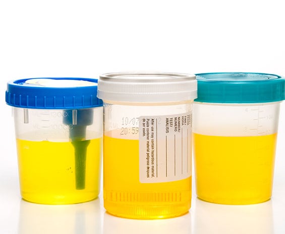 Toxicology Tox Confirmation for Urine and Oral Fluid Corona Pathology 1 - Toxicology (Tox Confirmation for Urine and Oral Fluid) Toxicology Tox Confirmation for Urine and Oral Fluid Corona Pathology 1 - Toxicology (Tox Confirmation for Urine and Oral Fluid)