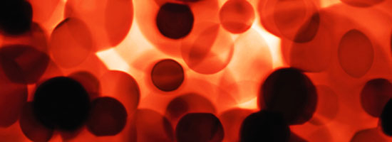 Understanding-Iron-Studies-Corona-Pathology