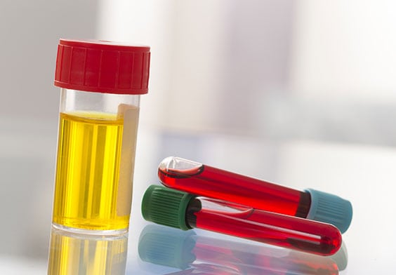 Urinalysis Laboratory in California Corona Pathology 1 - Urinalysis Laboratory in California Urinalysis Laboratory in California Corona Pathology 1 - Urinalysis Laboratory in California