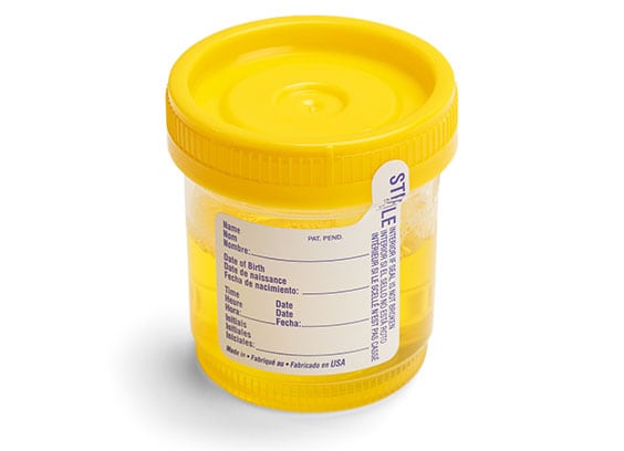 Urinalysis Laboratory in California Corona Pathology 2 - Urinalysis Laboratory in California Urinalysis Laboratory in California Corona Pathology 2 - Urinalysis Laboratory in California