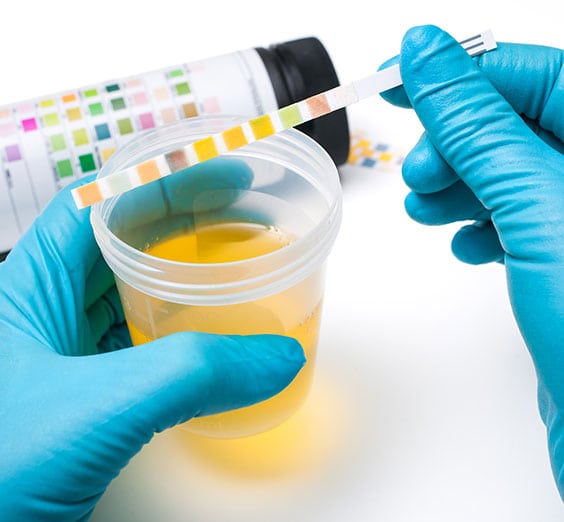 Urinalysis Laboratory in California Corona Pathology 3 - Urinalysis Laboratory in California Urinalysis Laboratory in California Corona Pathology 3 - Urinalysis Laboratory in California